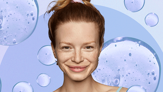 cicatrici da acne