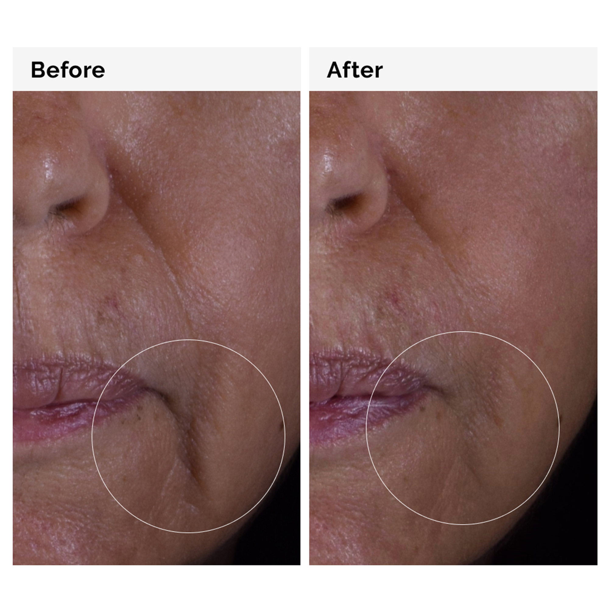 The Ordinary GF Solution 15% Serum 30ml
