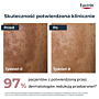 Eucerin Anti Pigment Serum o podwójnym Działaniu