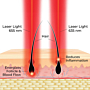 Hairmax Grzebień laserowy Dual Action 18 LaserComb