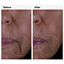 The Ordinary GF Solution 15% Serum 30ml