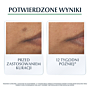 Eucerin Dermopure serum o Potrójnym Działaniu