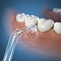Waterpik Końcówki klasyczne do irygatora JT-100E, 2 szt.