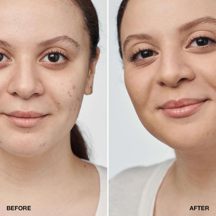 Clinique Even Better Clinical Serum-Foundation Podkład do twarzy, 52 Neutral