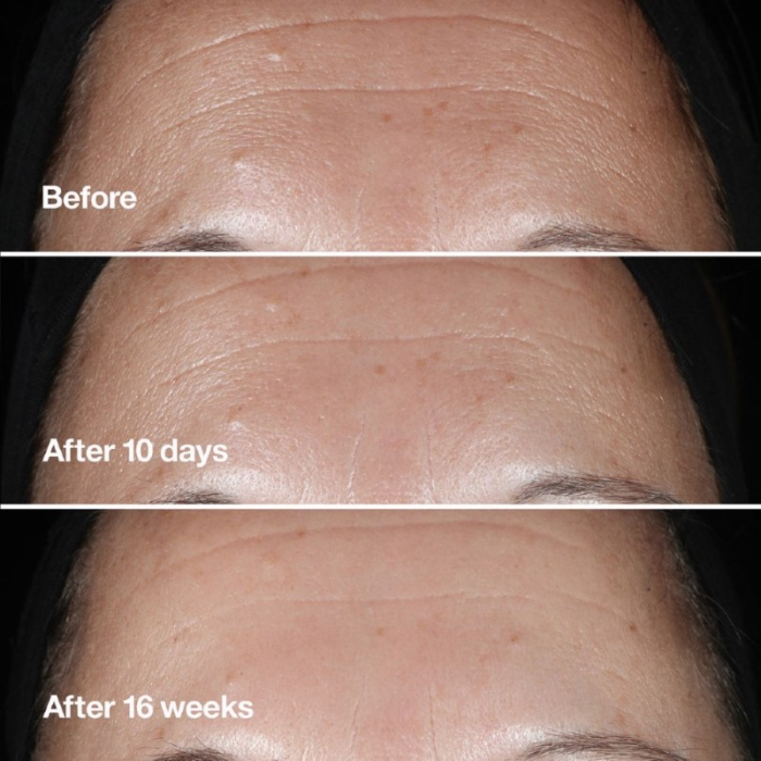 Clinique Smart Clinical Wrinkle Correcting Serum 50ml