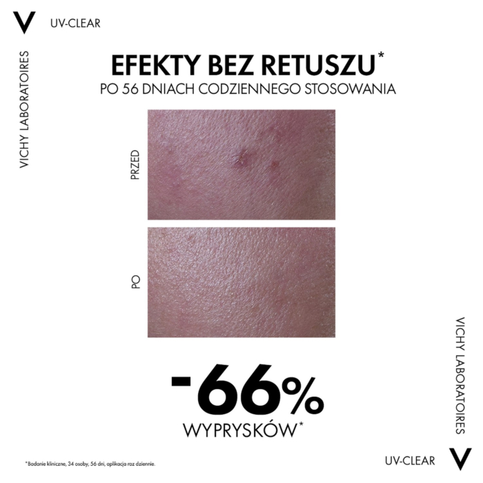 Vichy Capital Soleil Uv Clear Fluid przeciw niedoskonałościom SPF50+ 