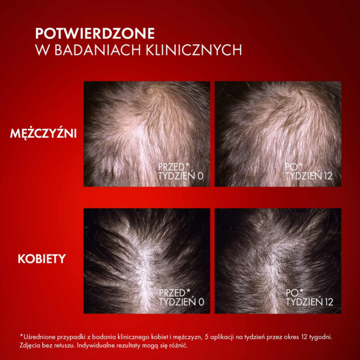 Vichy Dercos Aminexil R.E.G.E.N. Serum wzmacniające i stymulujące włosy