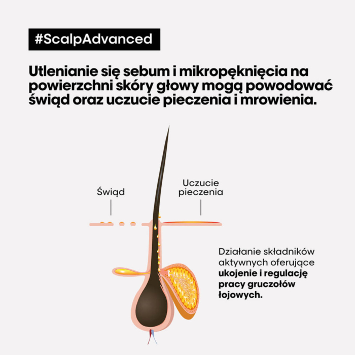 L’Oréal Professionnel SE Scalp Advanced Szampon kojący do wrażliwej skóry głowy, 300 ml