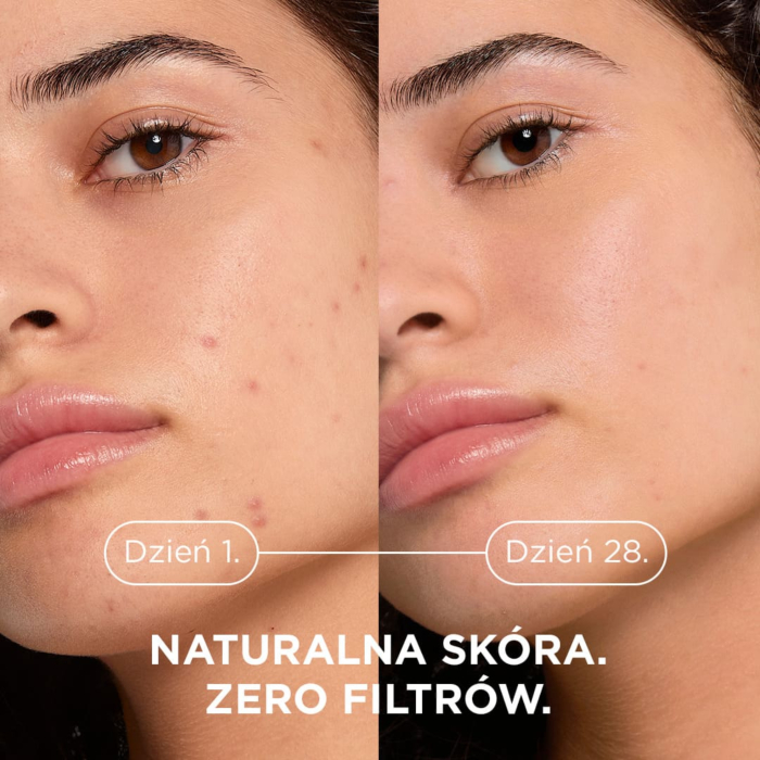 Bioderma Sebium Kerato+ Żel-krem