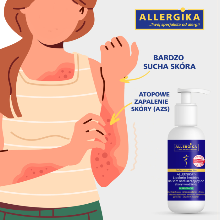 Allergika Lipolotio Sensitive Balsam natłuszczający 200 ml