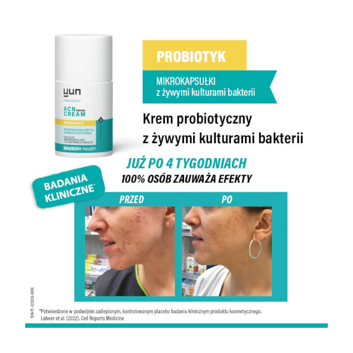 Yun Acn Repair Cream, Krem do Twarzy Probiotyczny, 50 ml 