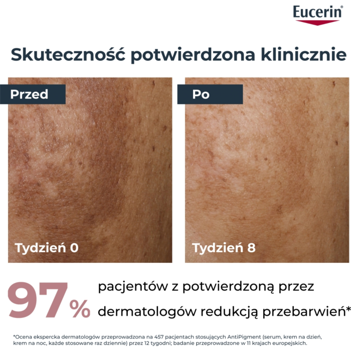Eucerin Anti Pigment Krem na dzień SPF 30