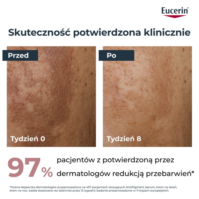 Eucerin Anti Pigment Serum o podwójnym Działaniu