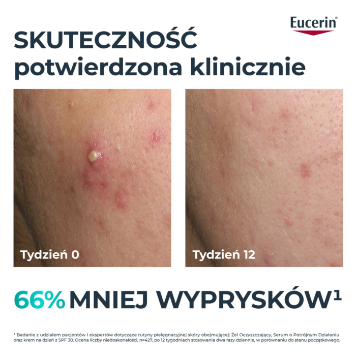 Eucerin Dermopure Clinical Serum o potrójnym działaniu