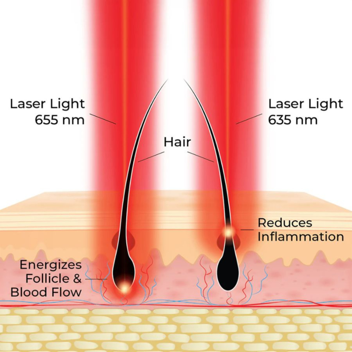 Hairmax Grzebień laserowy Dual Action 18 LaserComb