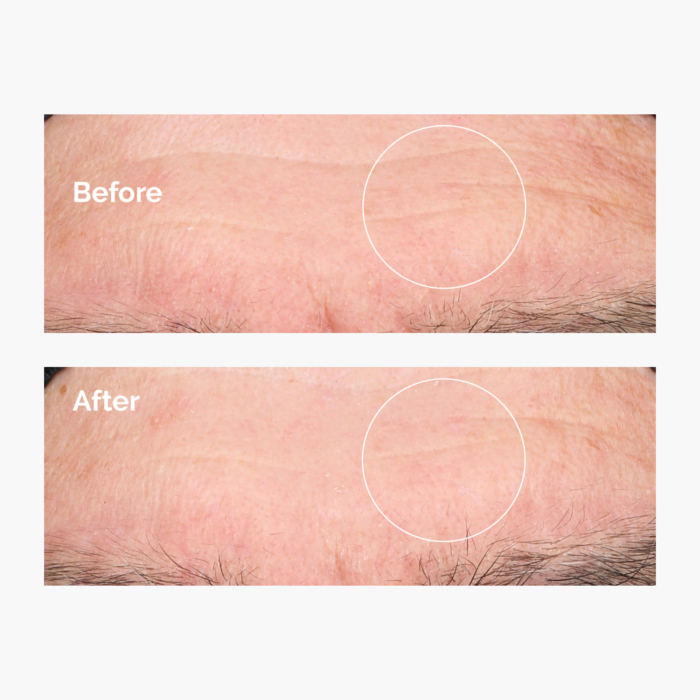The Ordinary Hyaluronic Acid 2% + B5 30ml