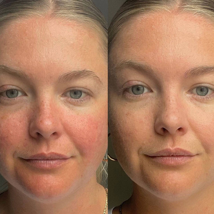 Dr.Jart+ Cicapair Tiger Grass Camo Drops SPF 35 Serum wyrównujące koloryt skóry z wąkrotką azjatycką