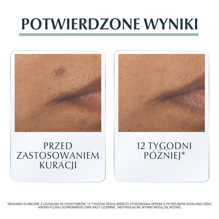 Eucerin Dermopure serum o Potrójnym Działaniu